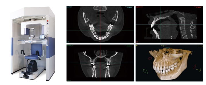 歯科用CT撮影装置